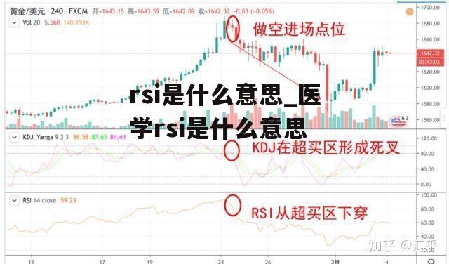 rsi是什么意思_医学rsi是什么意思